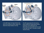 Anti-Snore Tongue Stabilizing Device Non-Invasive Nighttime Support - Image 4